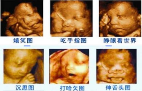 051696513948788222.png 3.png